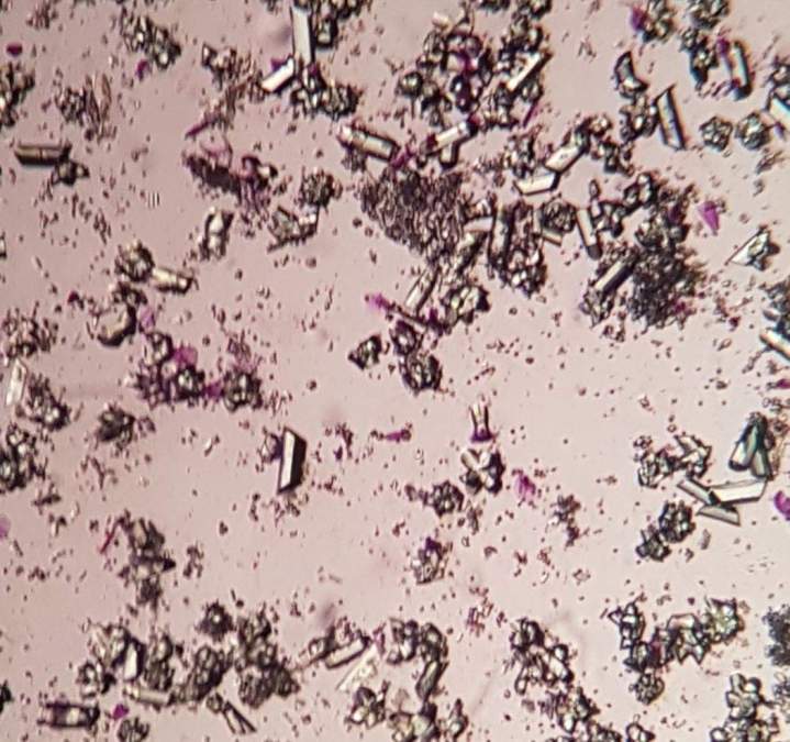 Laboratory analysis of feline urinary syndrome Laval